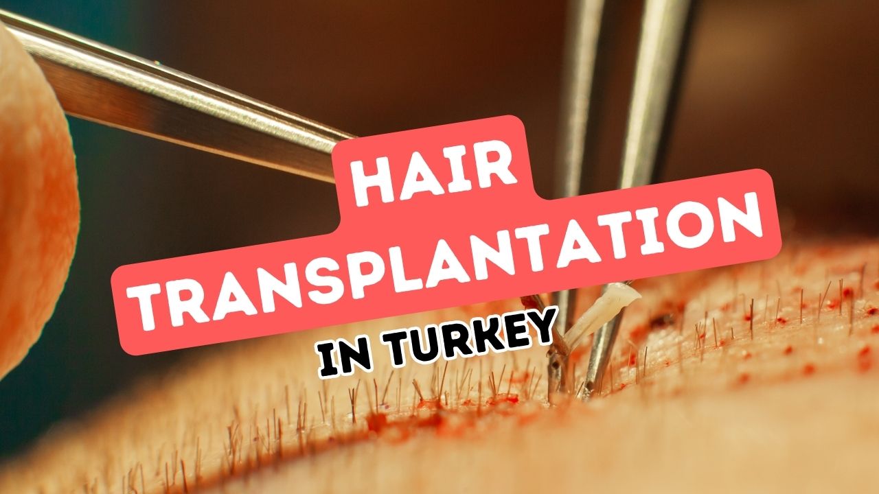 Hair Transplantation in Turkey: A Popular Choice for Foreigners